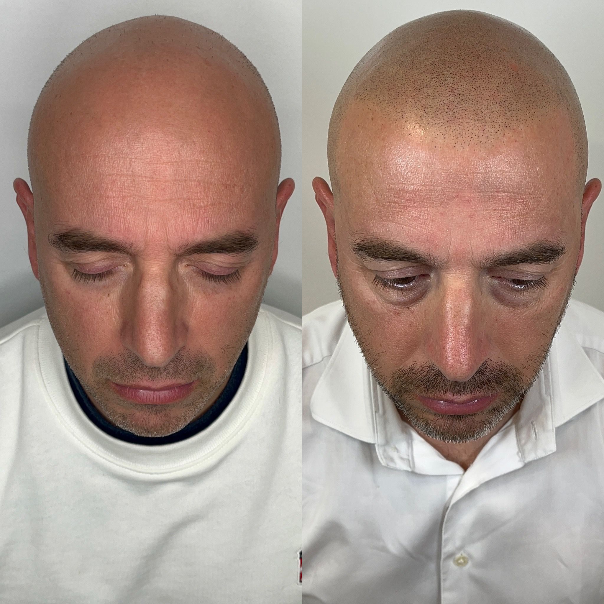 Línea Frontal Perfecta - SMP España