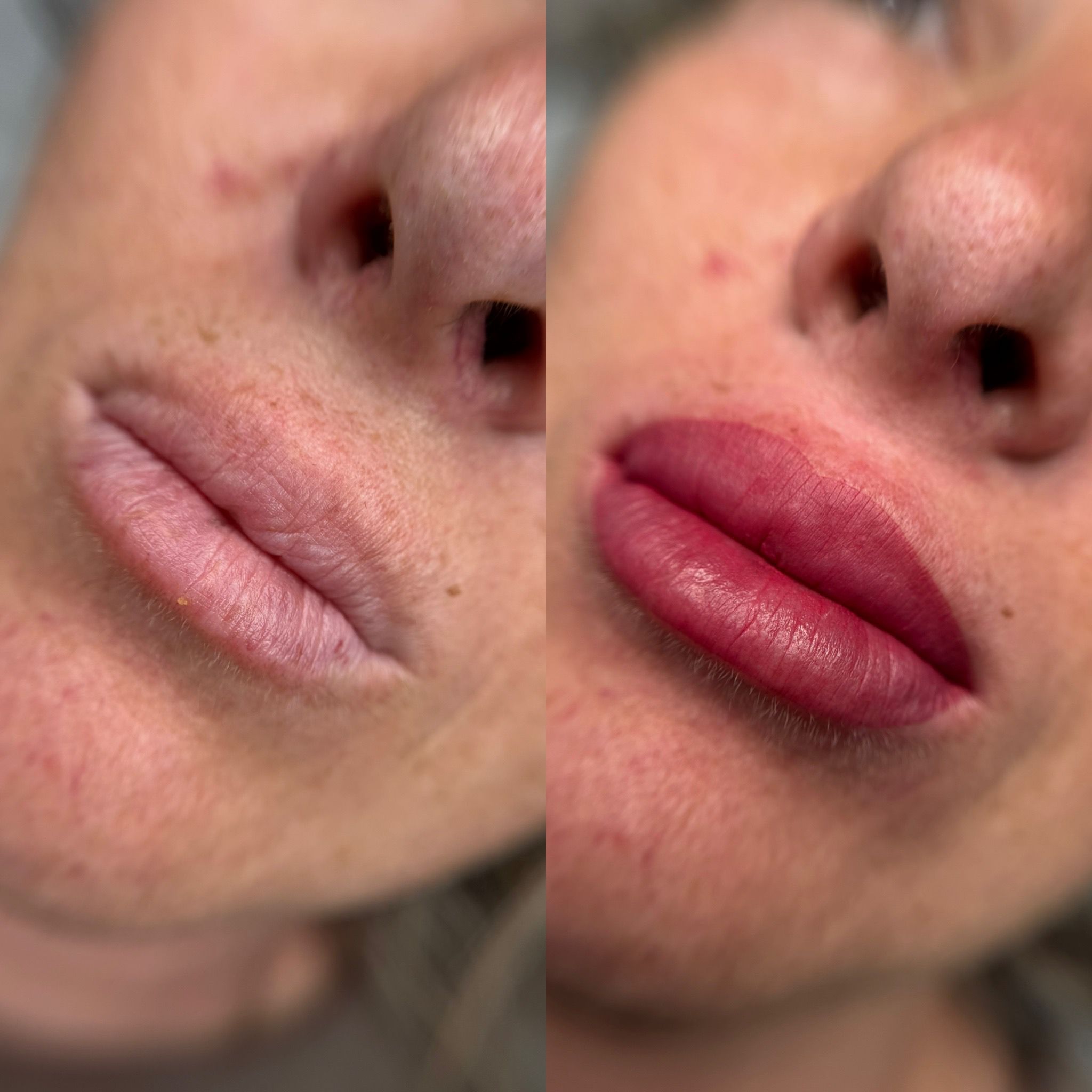 Corrección de asimetrías en labios mediante micropigmentación