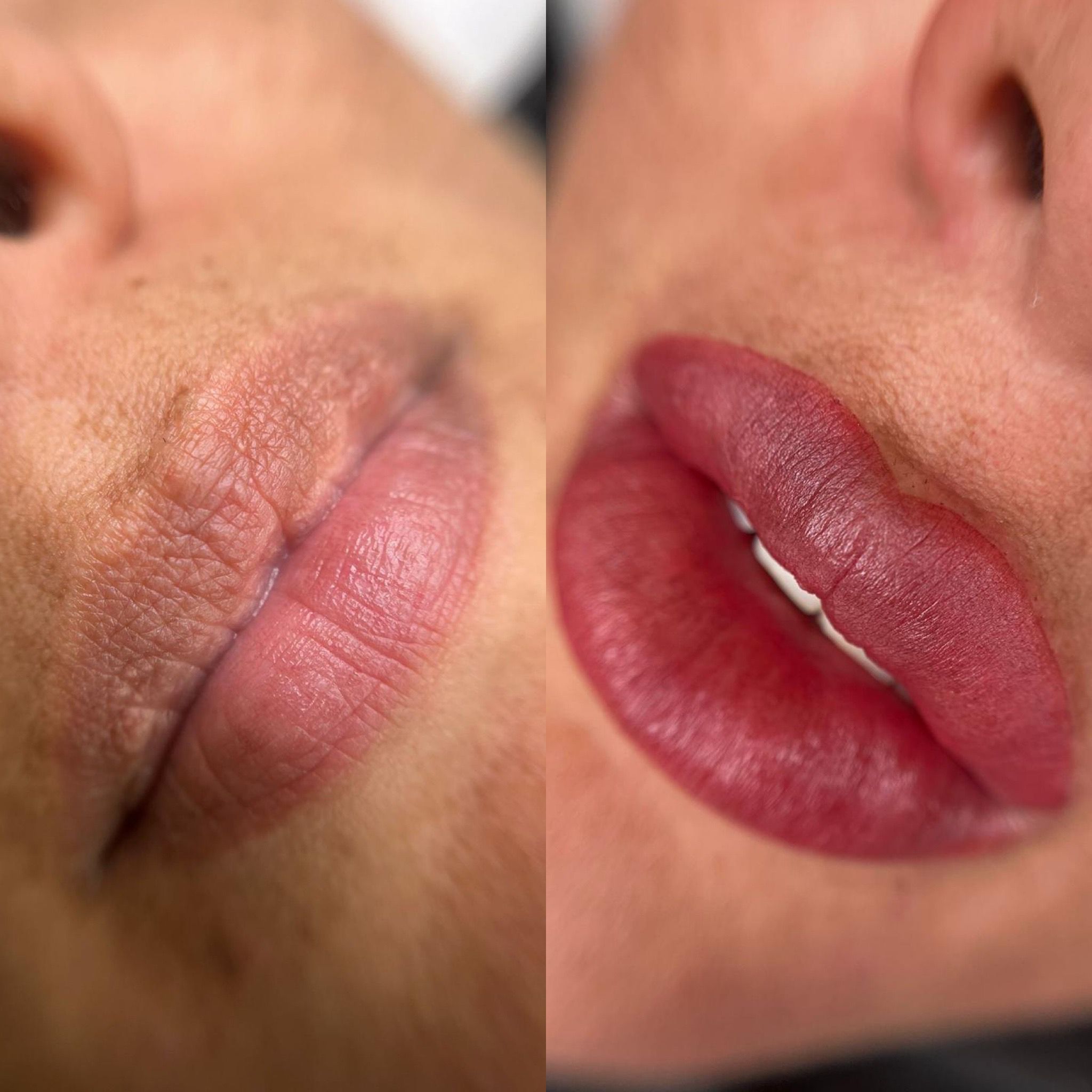 Neutralización de labios oscuros con resultado uniforme
