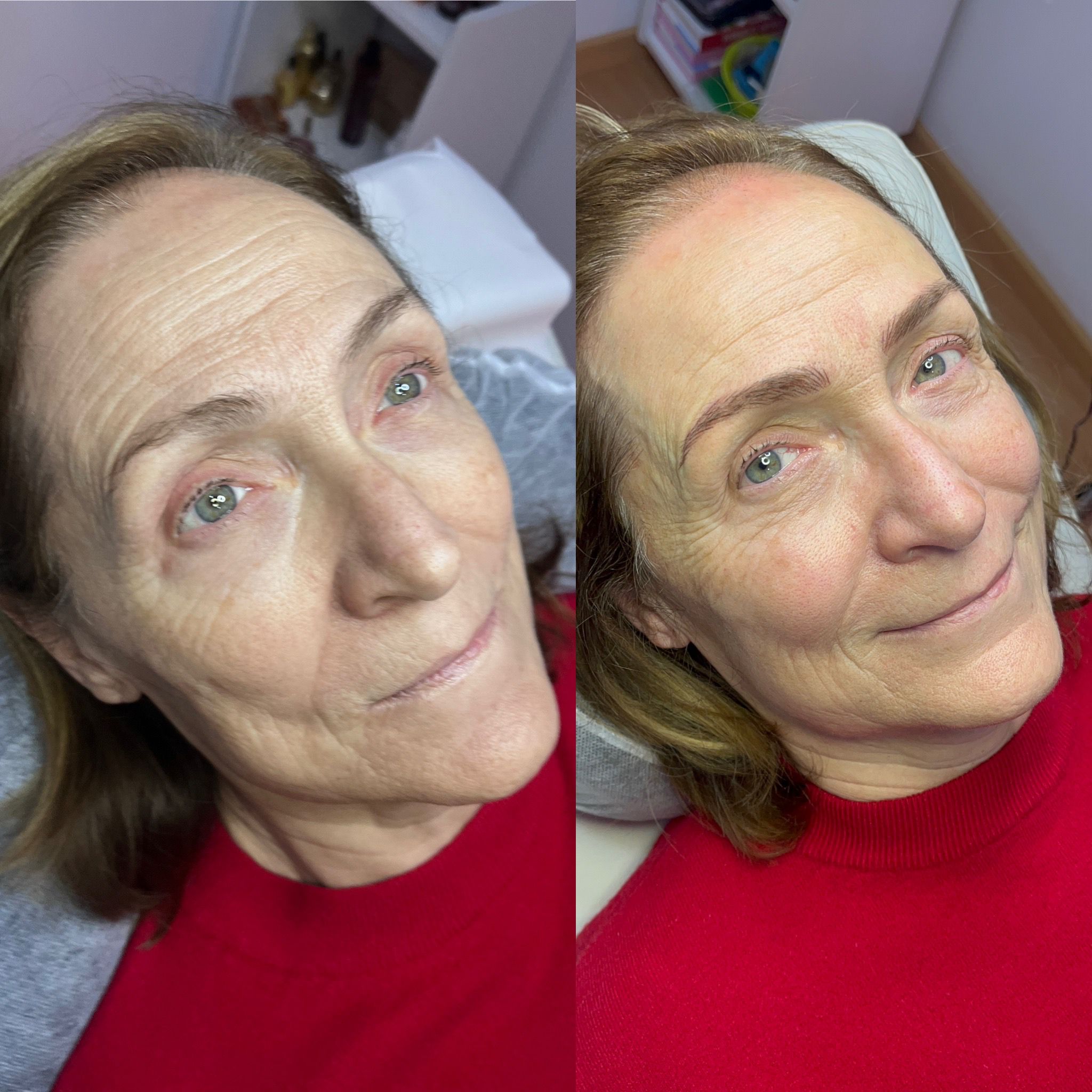 Corrección de asimetría en cejas con micropigmentación